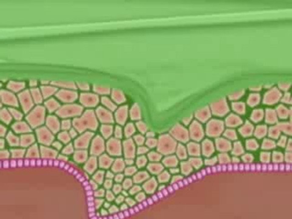 FRONTLINE combo chat