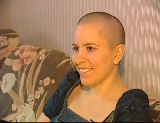 Another Bald Waitress Loses Job