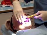 Blanchiment des dents par le Dr Jérémie Amzalag