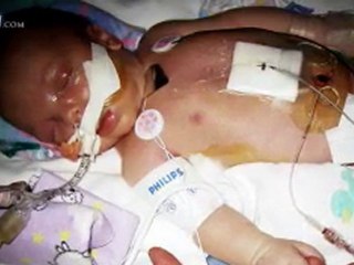 Patrick Shugart: Fighting to Live - CBN.com