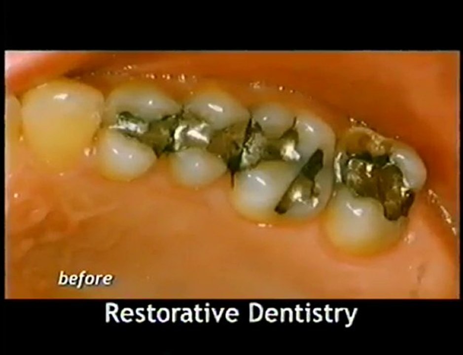 Minneapolis Dentist MN (952) 891-8484