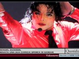 Michael Jackson, trovata una sua camicia sporca di sangue