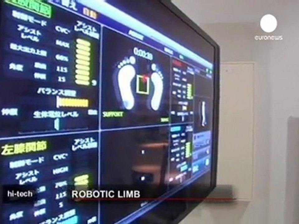 Hi-tech robot to restore limb movement