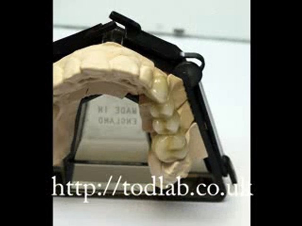 crown and bridge lab