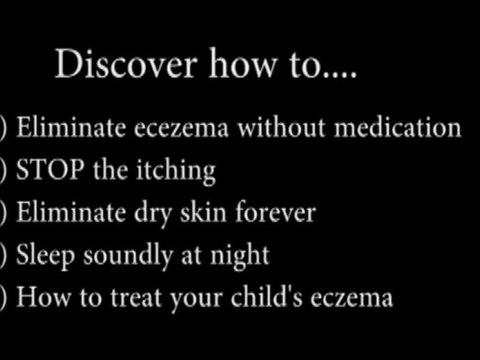 Natural Remedies For Eczema
