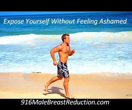 Gynecomastia Doctor Sacramento 916-484-4020