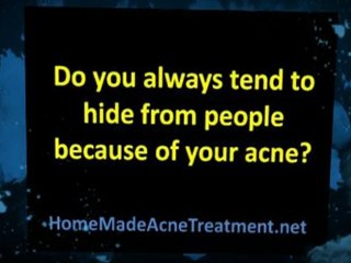 Acne No More: Natural Things Do Wonder