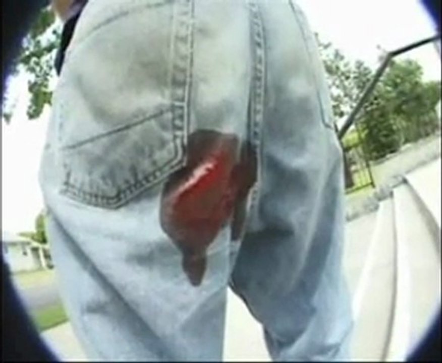 OUCH!!!