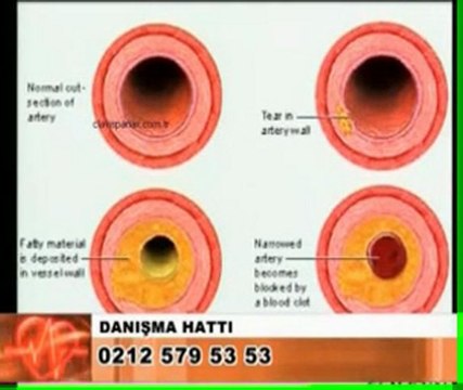dr, panax, clavis panax, dr mustafa eraslan, mustafa eraslan