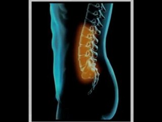 Surgical Spine Solutions