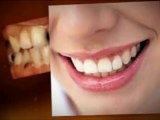 Cosmetic Dentist Harrisonburg VA:Considered A Smile Makeove
