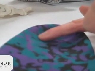 Orthotics for Calcaneal Apophysitis (heel pain in children)