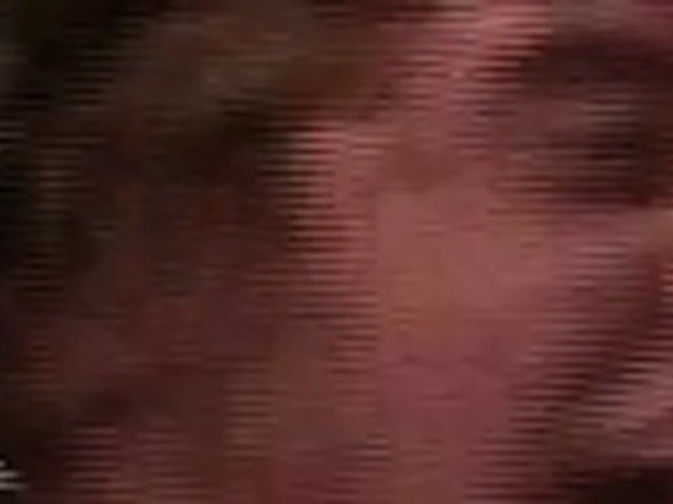 Teaser MBB