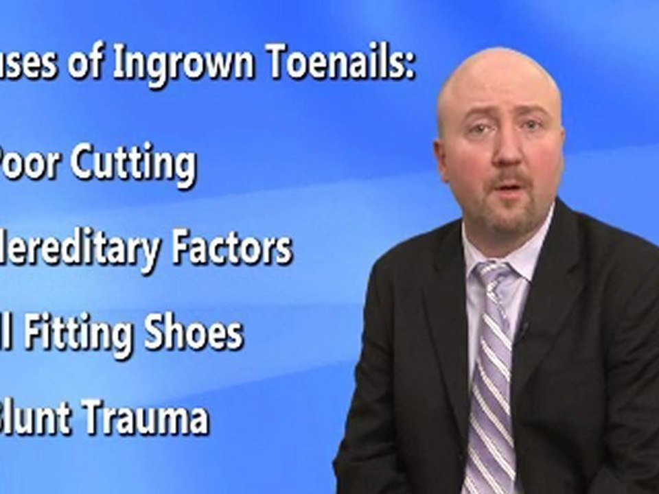 Ingrown Toenails - Chiropodist Waterloo and Kitchener, Ontar