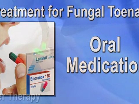 Fungal Toenails - Chiropodist Waterloo and Kitchener, Ontari
