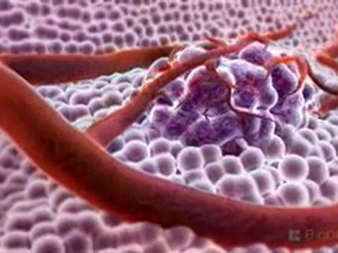3D Medical Animation - What is Cancer?