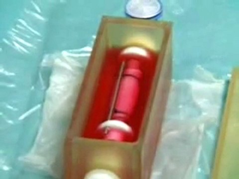 Windpipe transplant using stem cells.