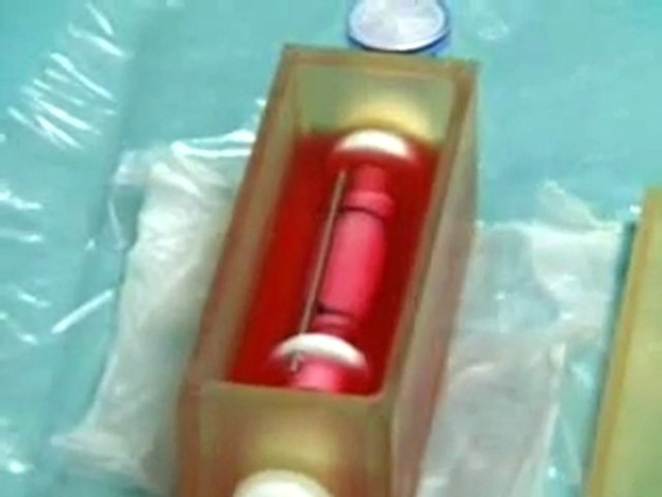 Windpipe transplant using stem cells.