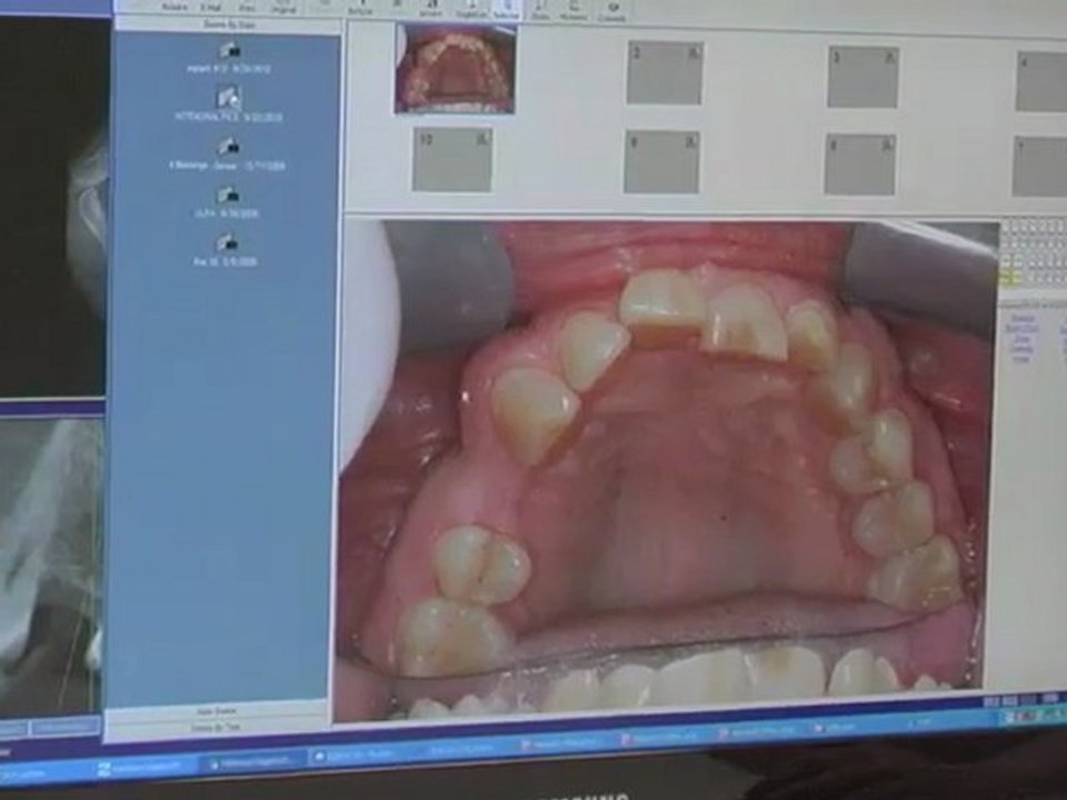 Orland Park Dentist | Orland Park Dentists | Dentist Orland