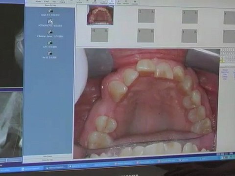 Orland Park Dentist | Orland Park Dentists | Dentist Orland