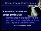 Comment réaliser un scanner pour EP chez la femme enceinte