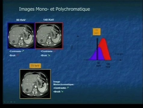 Applications pratiques du spectral CT