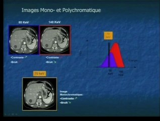 Applications pratiques du spectral CT