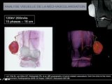 Nouvelles applications du CT en pathologie ostéo-articulaire