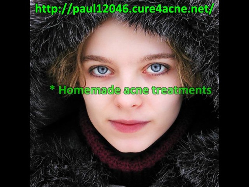 skin acne cure