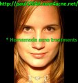 hormonal acne cures