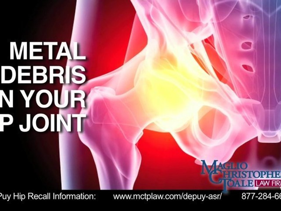 Q&A6-blood-test-for-depuy-hip-recall-patients
