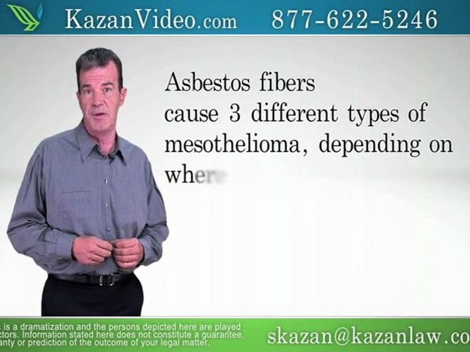 Mesothelioma Information Modesto - Asbestos Related Cases