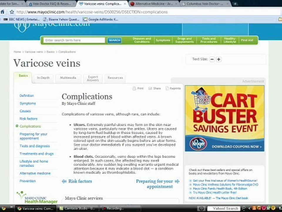 Varicose Vein Doctor Consultations and Information