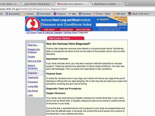 Varicose Vein Doctor Consultations and Information