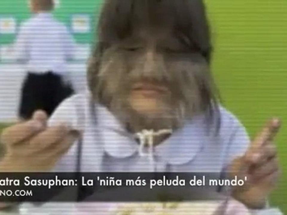 Supatra Sasuphan- La _niña mõs peluda del mundo