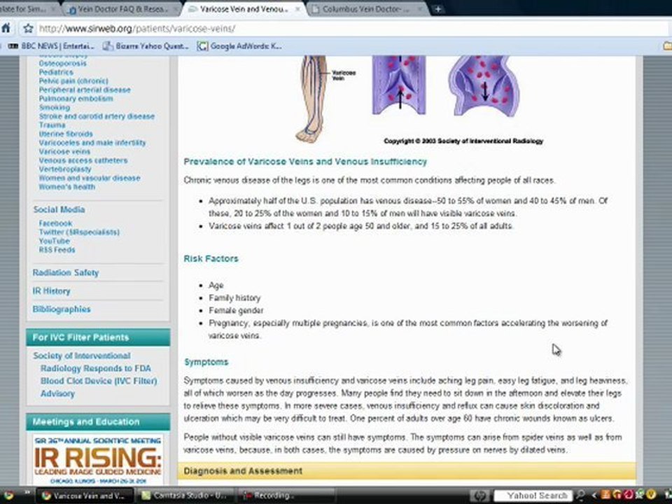 Varicose Vein Doctor Consultations and Information