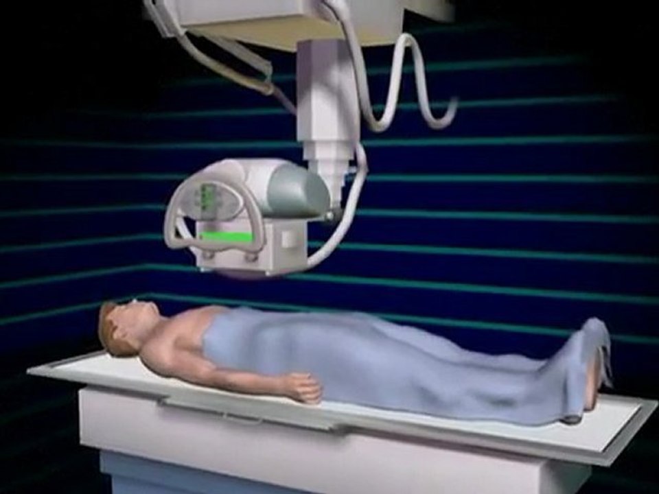 How do X-Rays Work? | Chiropractor Atlanta | Gainesville Ga