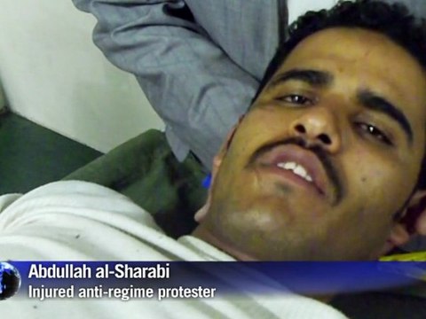 Yemen police open fire on protesters wounding four