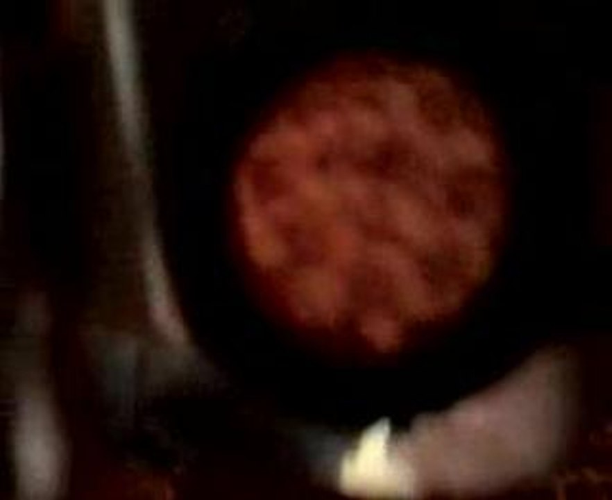 Autoportrait loupe