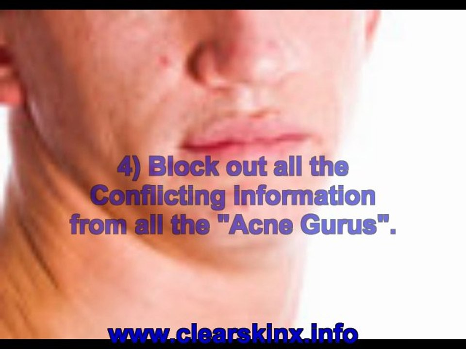 body acne