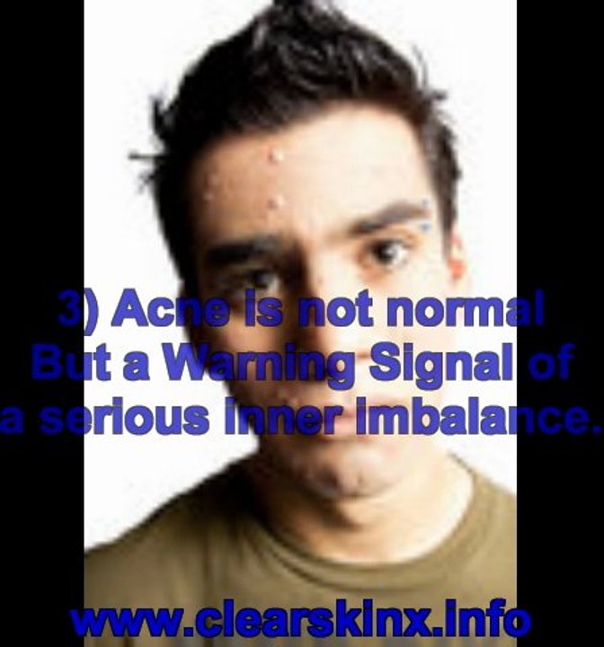 anti acne