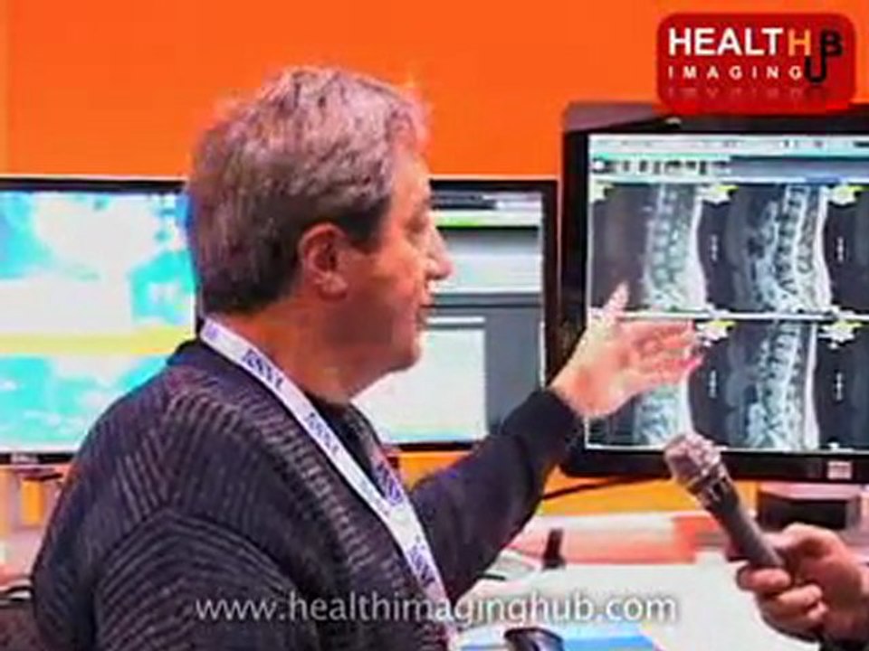 Key Features of Merge's PACS by Health Imaging Hub