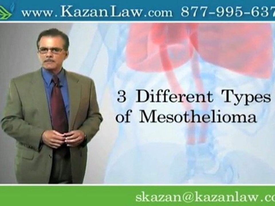 mesothelioma information