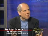 Dr. Daniel Amen - What You Need to Know About ADD