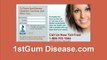 Gum Disease Dentist for Swollen Gums