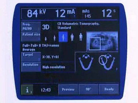 Promax 3D - Colocación Dcha de TMJ