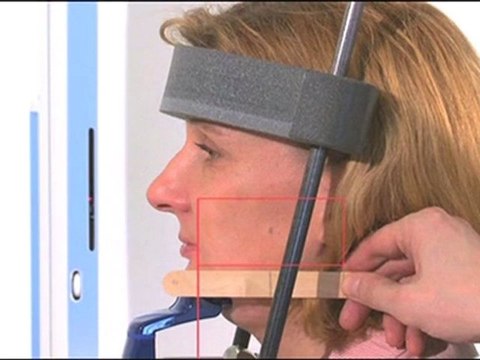 Promax 3D - Max-Colocación del Maxilar