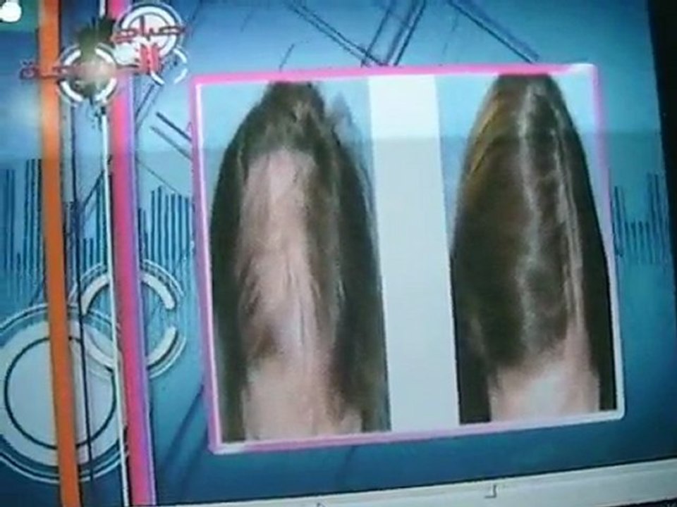 plastic surgery in qatar