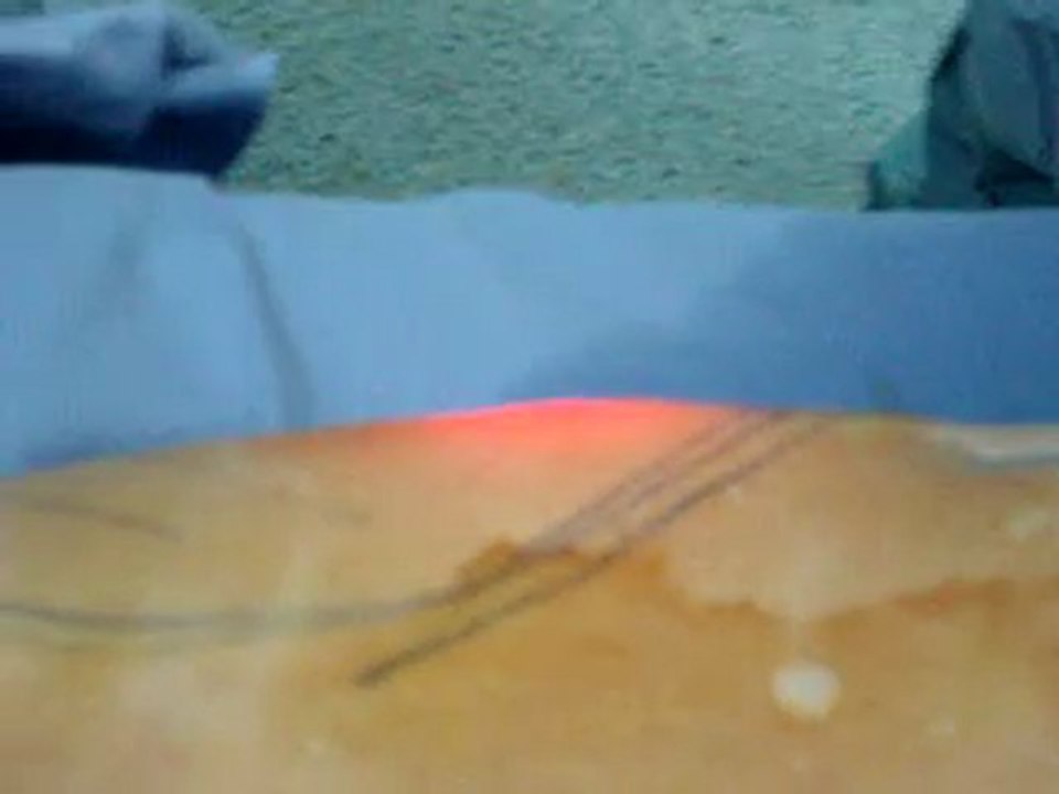 laser liposuction in qatar
