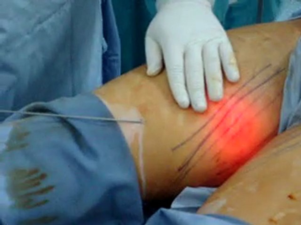laser in qatar